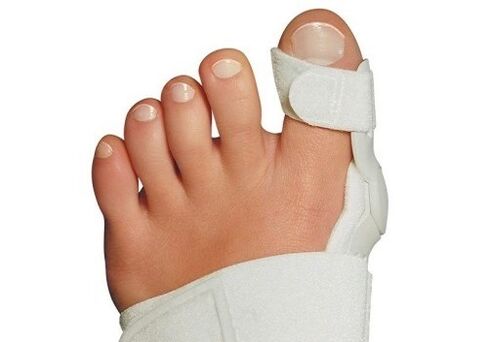 Deformarea Valgus