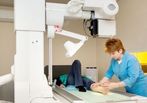 X -RAY picioare